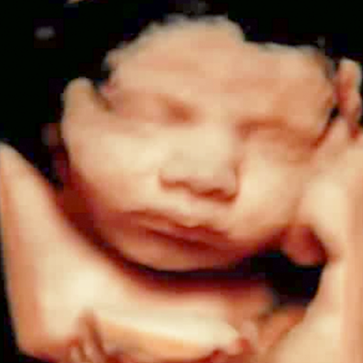 Best Prenatal Ultrasounds - HDLive 3D Ultrasound and 4D Ultrasound ...