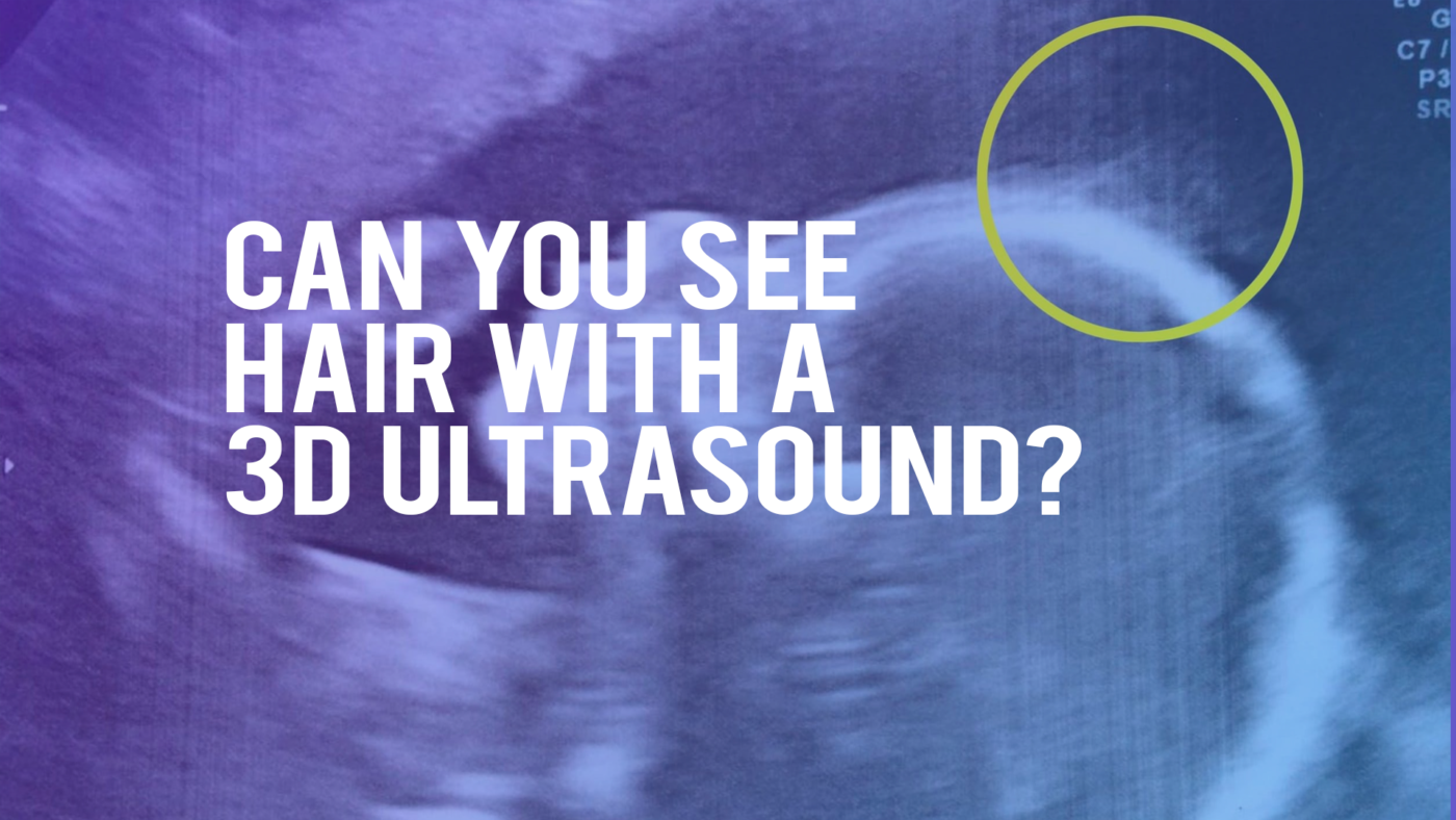 can you see hair with a 3d ultrasound