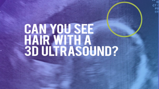 hair on 3d ultrasound